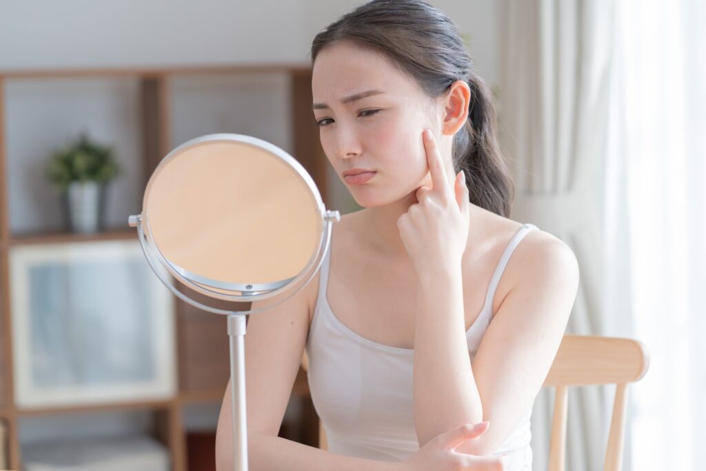肌荒れを気にする女性